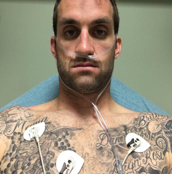 Davi Millsaps in hospital Davi Millsaps in hospital